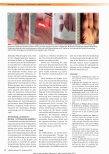 Vorschauseite 4: Physiotherapie zur Narbenreduktion - Effektivität und Grenzen