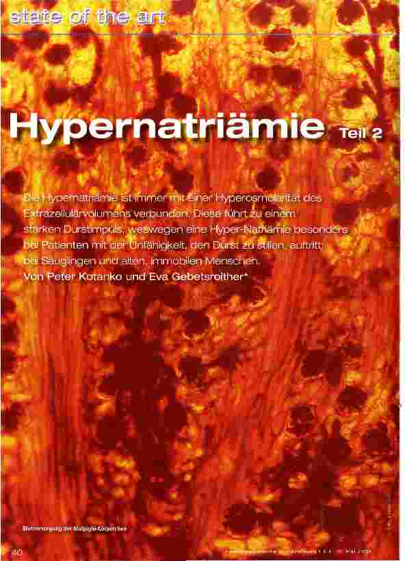 Vorschauseite 1: Hypernatriämie