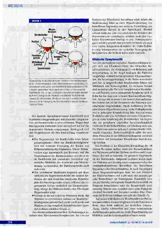 Vorschauseite 2: Die degenerative lumbale Spinalkanalstenose