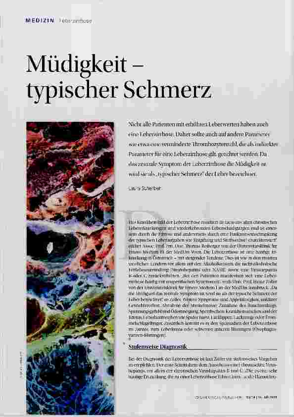 Vorschauseite 1: Müdigkeit - typischer Schmerz