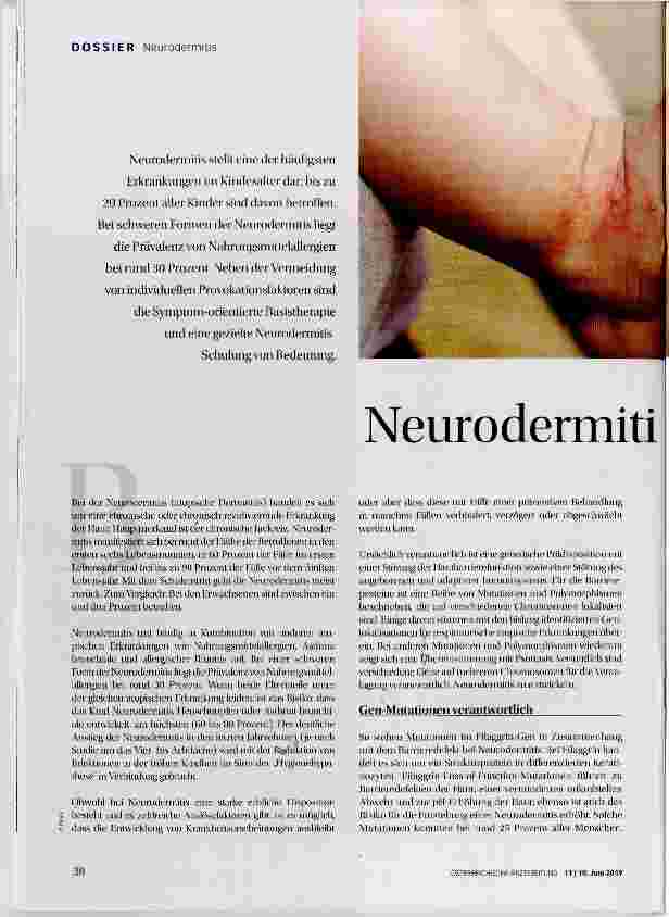 Vorschauseite 1: Neurodermitis bei Kindern