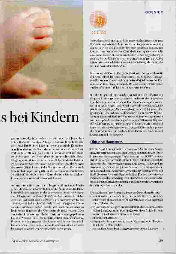 Vorschauseite 2: Neurodermitis bei Kindern