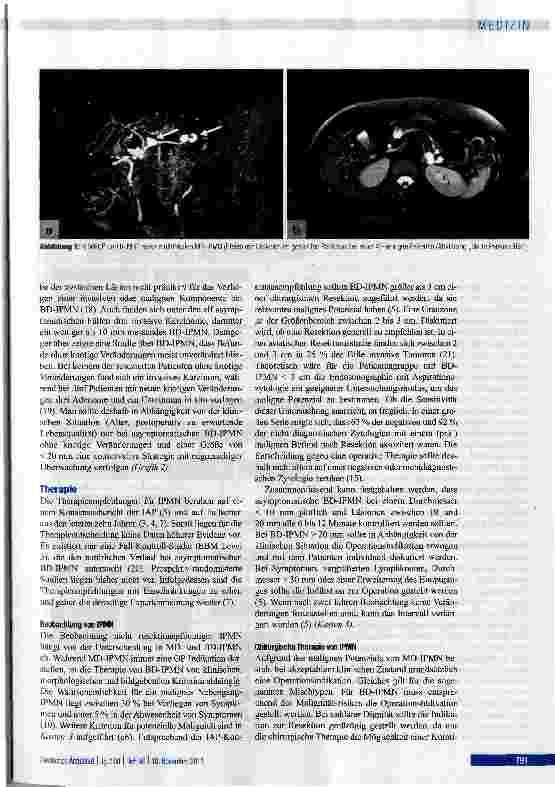 Vorschauseite 4: Intraduktale papillär-muzinöse Neoplasie desPankreas