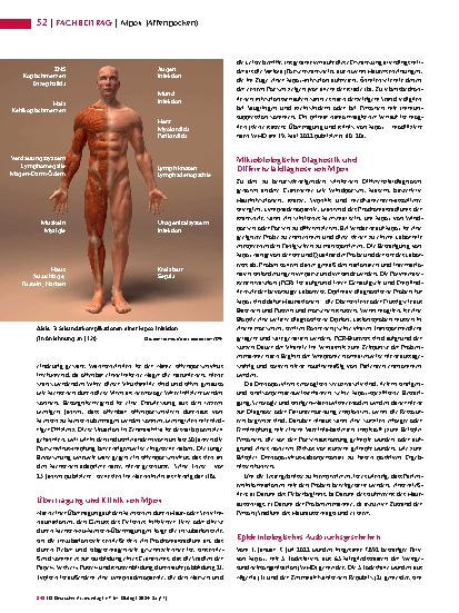 Vorschauseite 3: MPOX (Affenpocken)