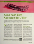 Vorschauseite 1: Akne nach dem Absetzen der „Pille“