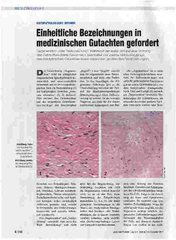 Vorschauseite 1: HISTOPATHOLOGISCHE BEFUNDE Einheitliche Bezeichnungen in medizinischen Gutachten gefordert