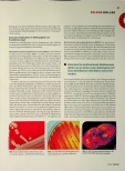 Vorschauseite 2: Risiko Dialyse