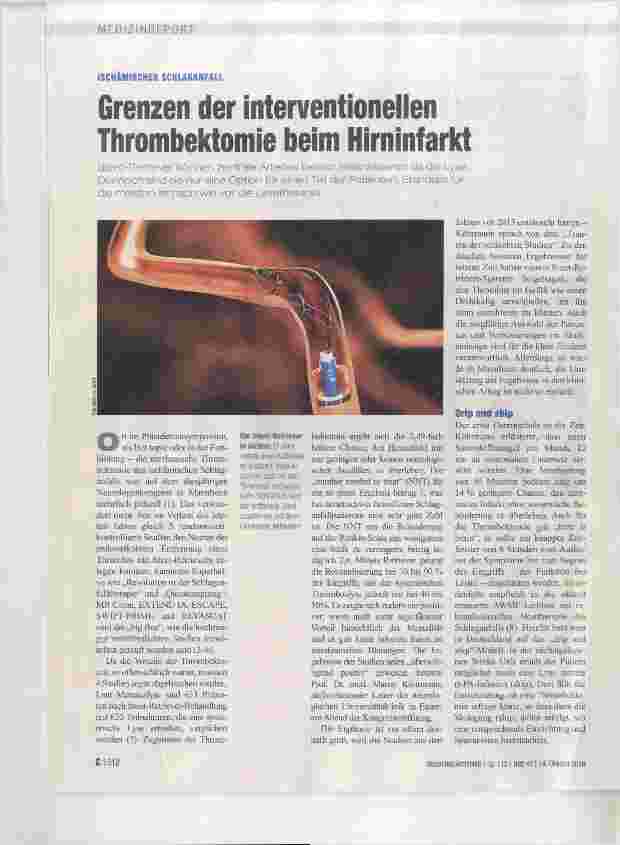 Vorschauseite 1: Grenzen der interventioneilen Thrombektomie beim Hirninfarkt