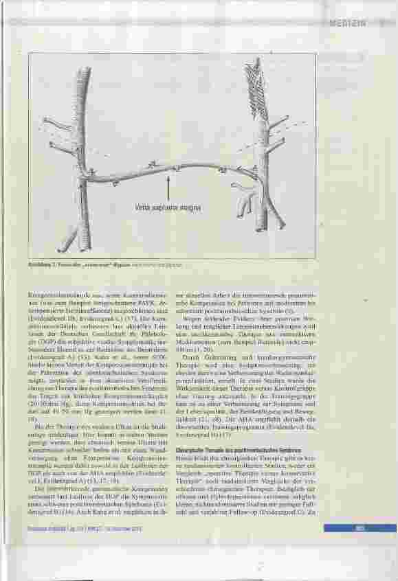 Vorschauseite 3: Therapie des postthrombotischen Syndroms