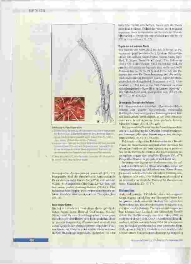 Vorschauseite 6: Therapie des postthrombotischen Syndroms