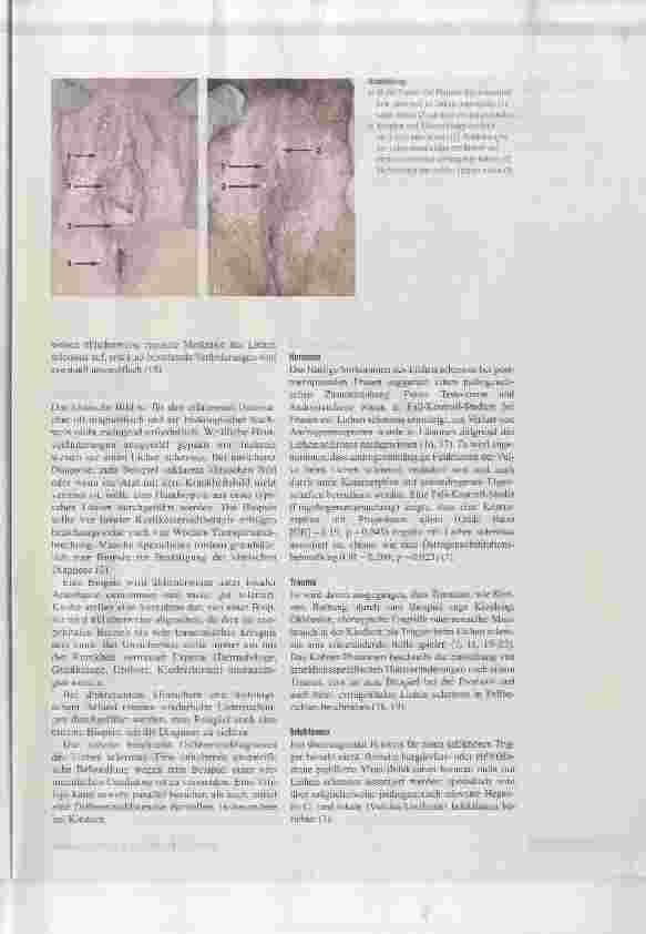 Vorschauseite 3: Lichen sclerosus Beratungsanlass, Diagnose und therapeutisches Procedere