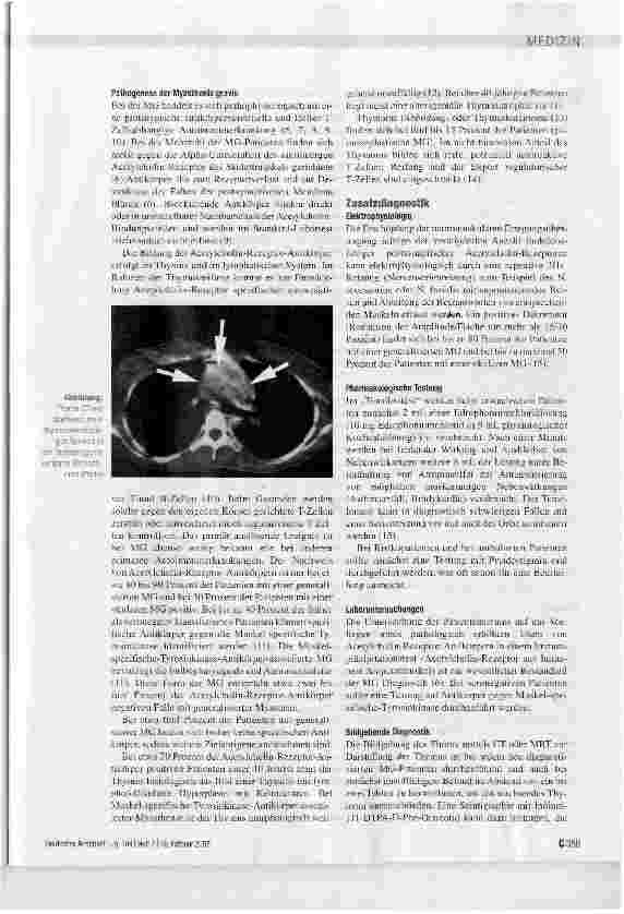 Vorschauseite 3: Myasthenia gravis: Pathogenese und Immuntherapie