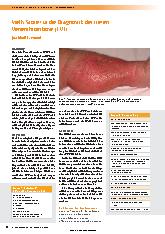 Vorschauseite 1: Wells-Score für die Diagnostik der tiefen Venenthrombose (TVT)