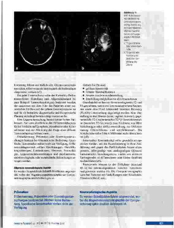 Vorschauseite 3: Die Gliome des Erwachsenen