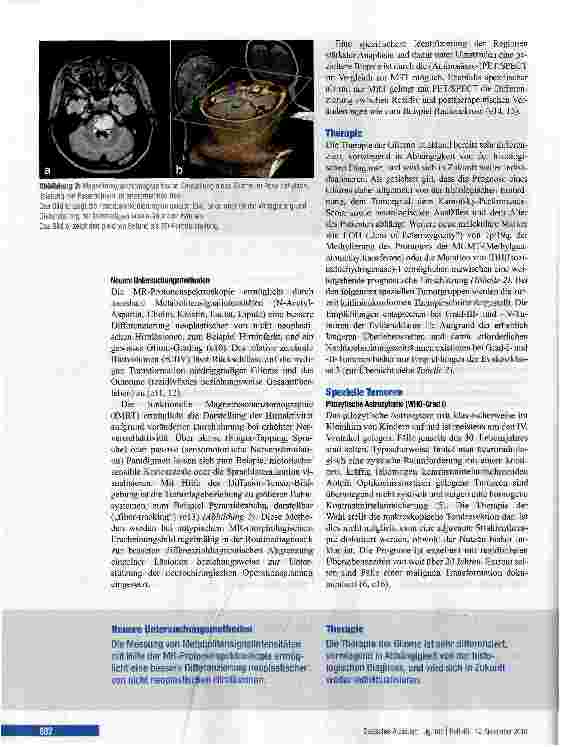 Vorschauseite 4: Die Gliome des Erwachsenen