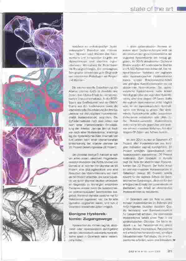 Vorschauseite 2: Hysterektomie