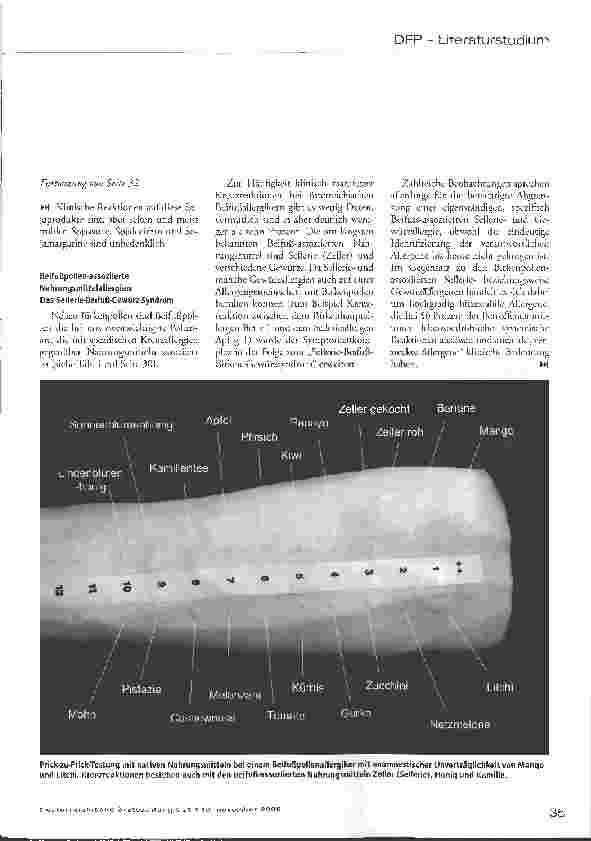 Vorschauseite 5: Sekundäre Nahrungsmittelallergien