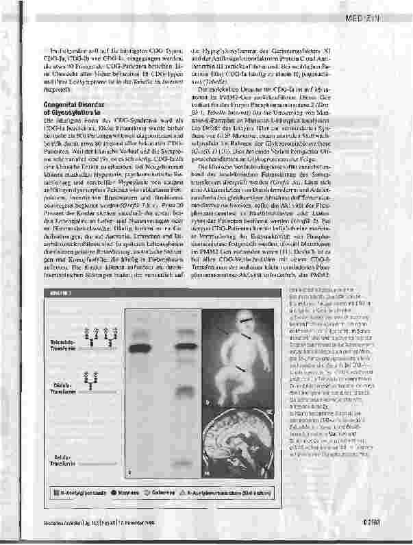 Vorschauseite 4: Multisystemische Erkrankungen im Kindesalter durch erbliche Defekte der Glykoproteinbiosynthese