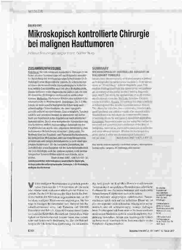 Vorschauseite 1: Mikroskopisch kontrollierte Chirurgie bei malignen Hauttumoren