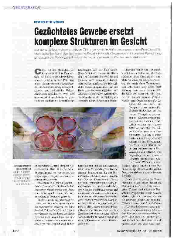 Vorschauseite 1: Gezüchtetes Gewebe ersetzt komplexe Strukturen im Gesicht