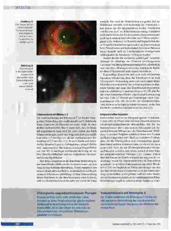 Vorschauseite 6: Medikamentöse und chirurgische Therapie des Glaukoms