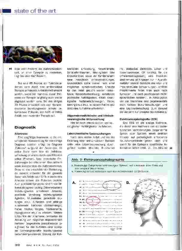Vorschauseite 3: Epilepsie