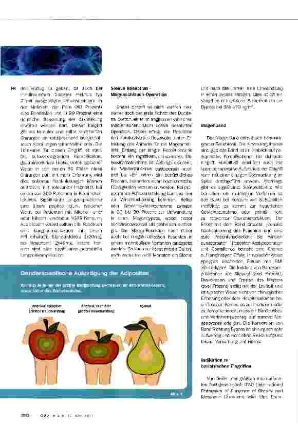 Vorschauseite 5: Morbide Adipositas