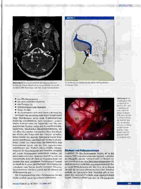 Vorschauseite 3: Hemispasmus facialis