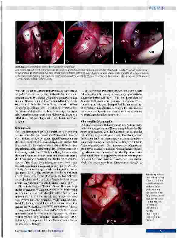 Vorschauseite 5: Hemispasmus facialis