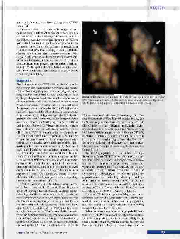 Vorschauseite 2: Chronisch thromboembolische pulmonale Hypertonie