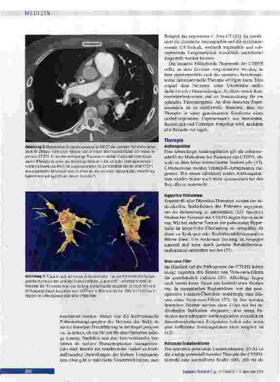 Vorschauseite 3: Chronisch thromboembolische pulmonale Hypertonie