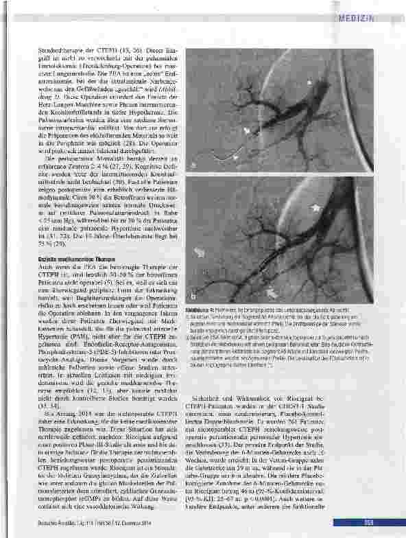 Vorschauseite 4: Chronisch thromboembolische pulmonale Hypertonie