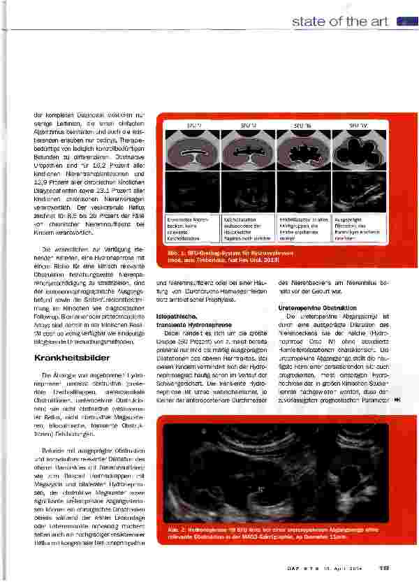 Vorschauseite 2: Kindliche Hydronephrose