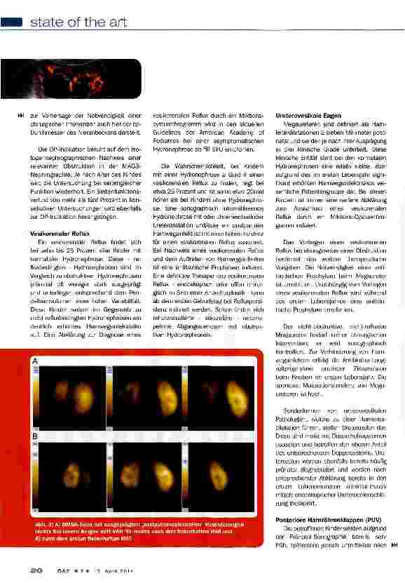 Vorschauseite 3: Kindliche Hydronephrose