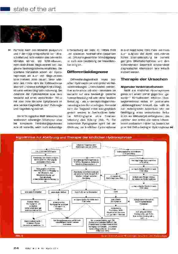 Vorschauseite 5: Kindliche Hydronephrose