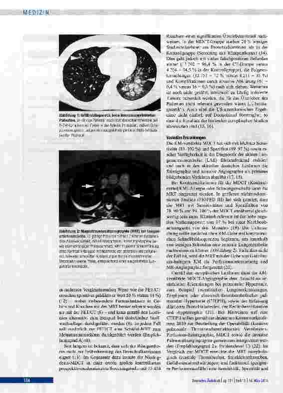 Vorschauseite 4: Radiologische Diagnostik von Lungenerkrankungen