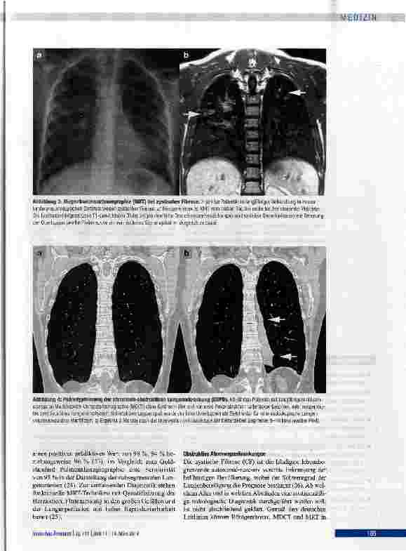 Vorschauseite 5: Radiologische Diagnostik von Lungenerkrankungen