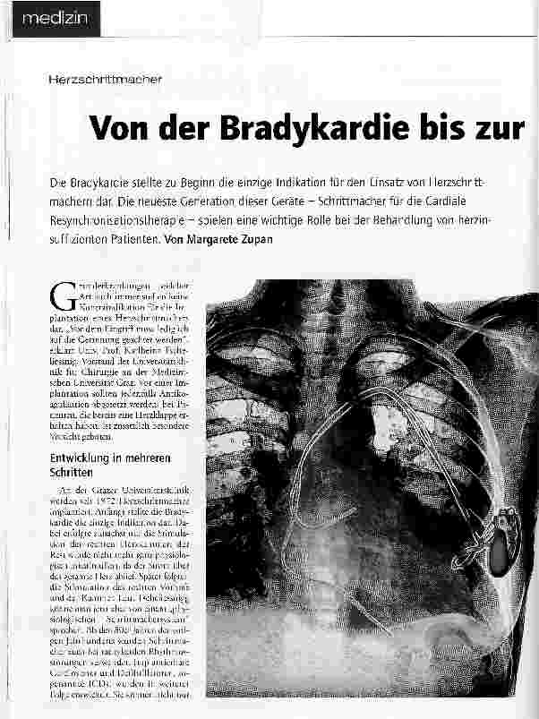 Vorschauseite 1: HerzschrittmacherVon der Bradykardie bis zur Herzinsuffizienz