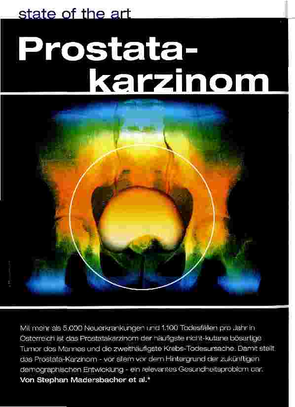 Vorschauseite 1: Prostata-Karzinom