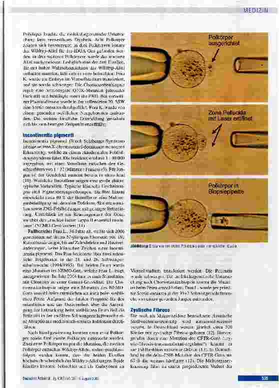 Vorschauseite 3: Polkörperdiagnostik für monogene Erkrankungen