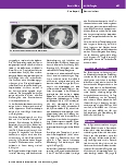 Vorschauseite 3: Bridging to Recovery mittels ECMO-Therapie bei E-Zigaretten-assoziiertem Lungenschaden (EVALI) bei einem 19-jährigen Patienten