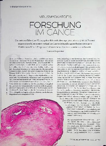 Vorschauseite 1: Virusmyokarditis Forschung im Gange