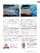 Vorschauseite 3: Liegedauer von Venenverweilkanülen: Ist ein programmierter Wechsel sinnvoll?