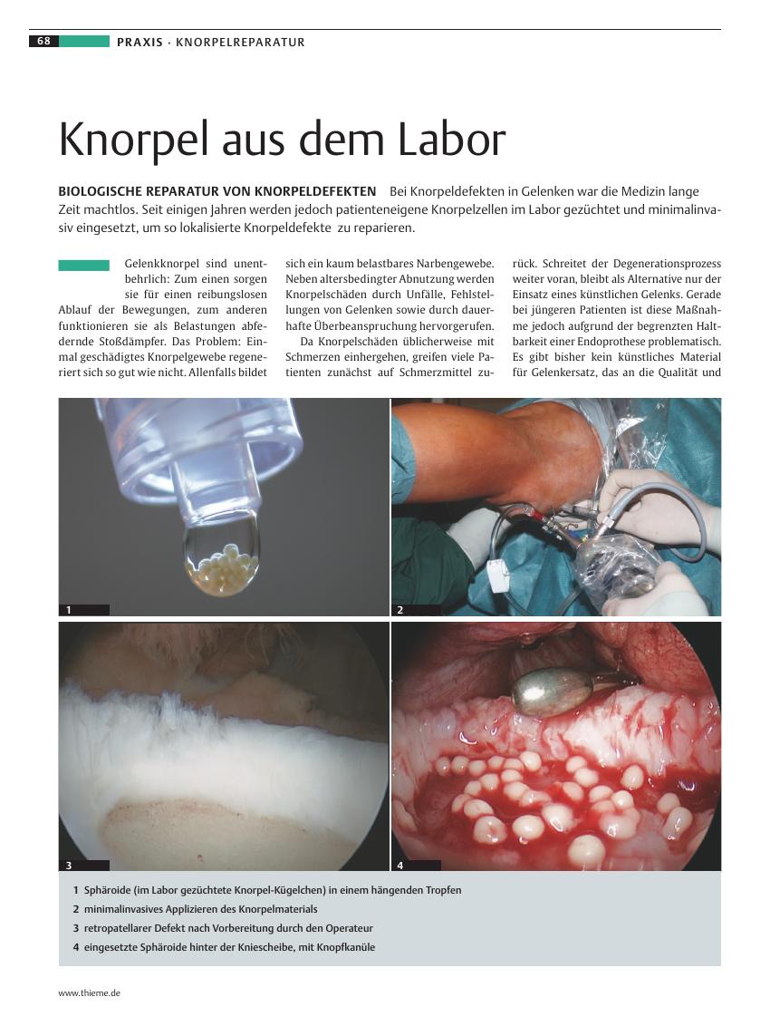 Vorschauseite 1: Knorpel aus dem Labor
