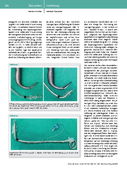 Vorschauseite 3: Videolaryngoskopie – immer und überall? Wissenschaftliche Evidenz und aktueller Stellenwert der Videolaryngoskopie in der Anästhesiologie