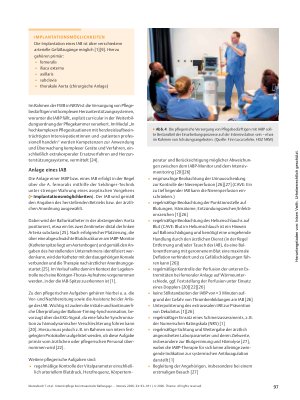 Vorschauseite 5: Intensivpflege bei intraaortaler Ballongegenpulsation – was muss beachtet werden?