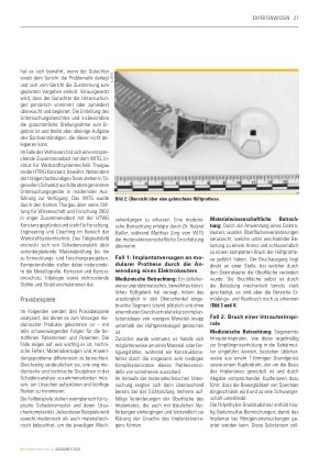 Vorschauseite 4: Schadensanalyse für Medizinprodukte-Gutachten