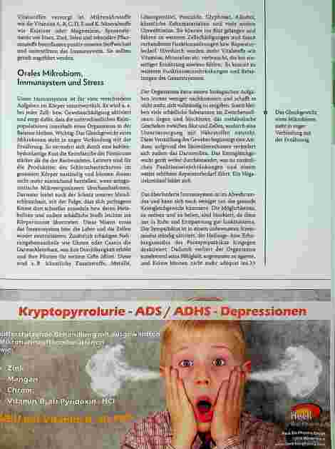 Vorschauseite 3: Parodontitis - eine Betrachtung aus ganzheitlicher Sicht