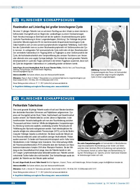 Vorschauseite 1: Perikardiale Tuberkulose