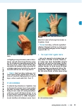 Vorschauseite 6: Das Gewölbeprinzip der Hand funktionell verstehen: Handtherapie nach den Prinzipien der Spiraldynamik.